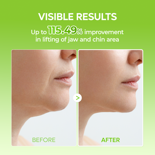 CACTOX V-Lifting Mewing Band 4EA
